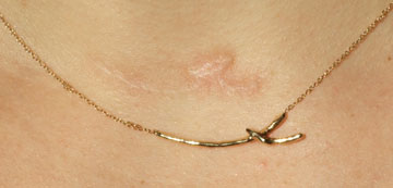 Уникальные украшения в виде шрама