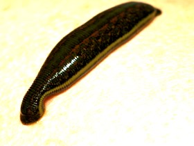 Бизнес на пиявках